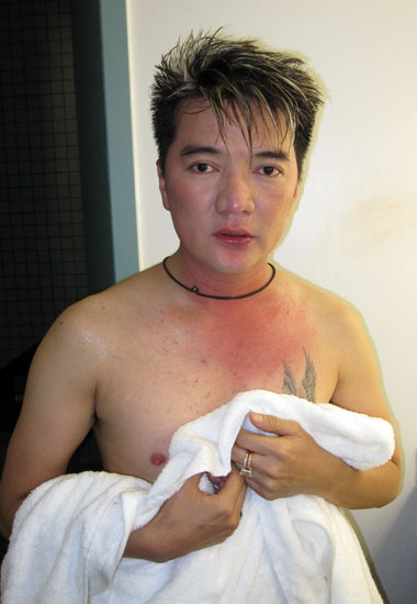 Đ�m Vĩnh Hưng sau khi bị tấn c�ng.